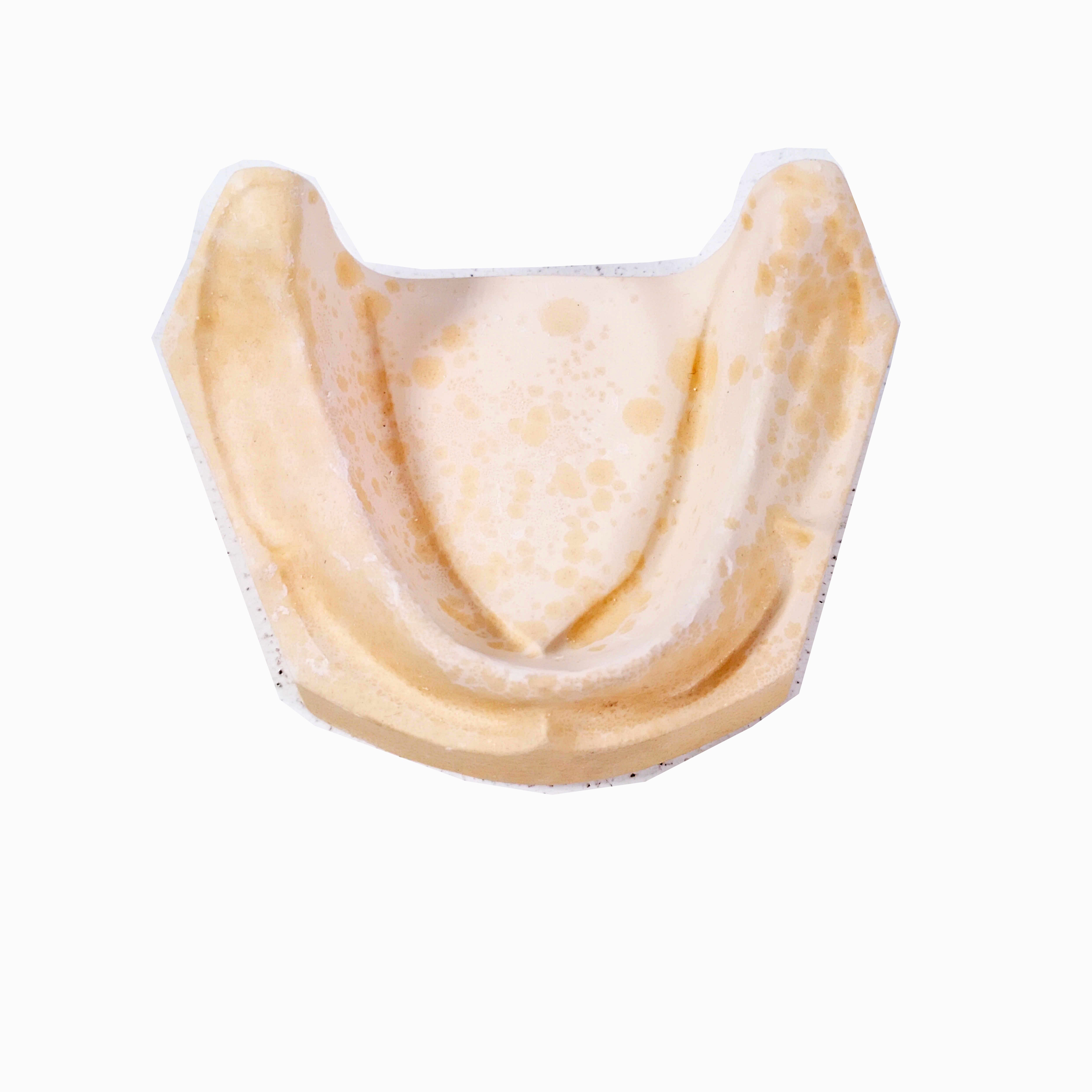 Edentulous Cast
